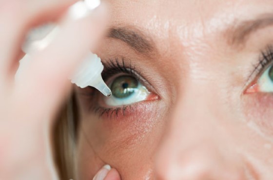 Nejčastěji využívanou konzervativní metodou léčby glaukomu, jsou speciální oční kapky, snižující projevy tohoto onemocnění; zdroj: health.clevelandclinic.org